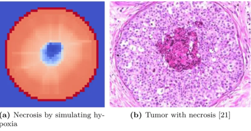 Figure 12: Tumors with a necrotic center.