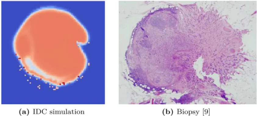 Figure 2: Main result : qualitative comparison of our simulation with biopsy.