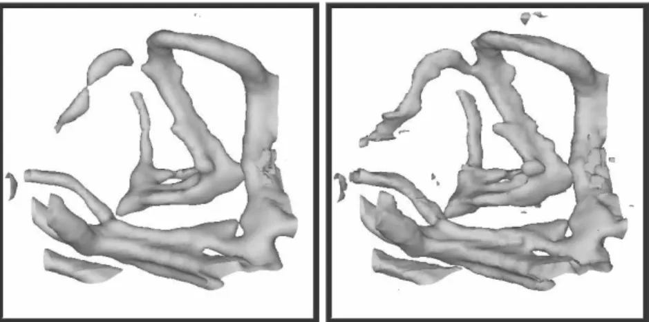 Figure 5: Isosufaces with threshold of 1000. On the left anisotropic diffusion with Green function