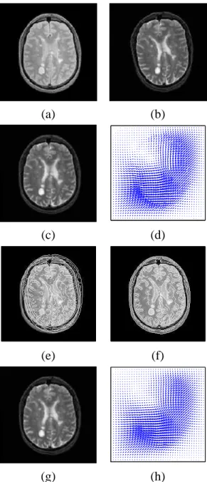 Figure 3: PD/T2 MRI realignment with MI and CR comparison functions (regu- (regu-larization using linear elasticity) : (a) reference image (PD 200x200), (b) image to register (T2 200x200), (c) image (b) after realignment (MI), (d) recovered  displace-ment 