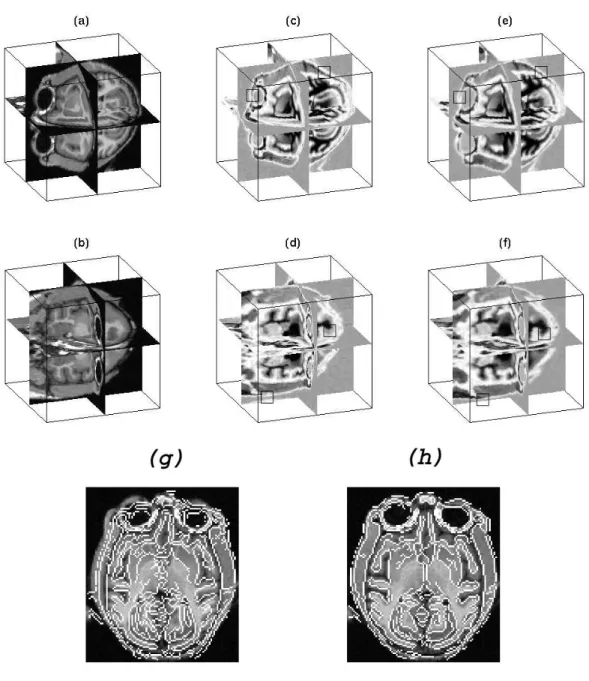 Figure 4: Realignment of MRI volumes (synthetic example with MI and linear elasticity) : (a) and (b) two views of the reference volume (T2 66x111x97), (c) and (d) volume to register (66x111x97), (e) and (f) volume after realignment, (g) and (h) contours of