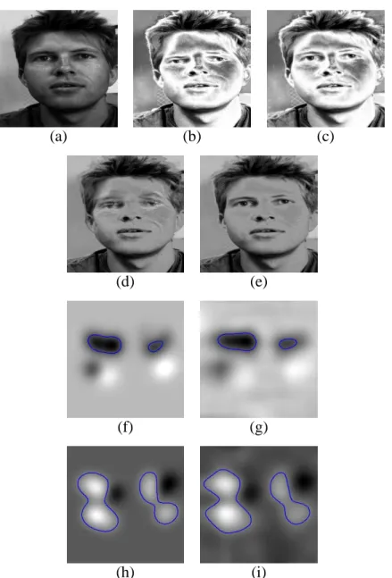 Figure 5: 2D-Matching with Gaussian-smoothing regularization : (a), (b) and (c) reference, target and registered images