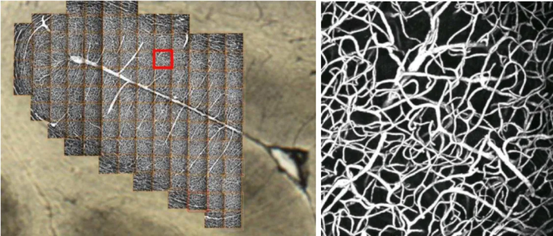 Figure 2: An image mosaic corresponding to the sulcus area of Figure 1 (b) and a sample of a single confocal image of this mosaic.