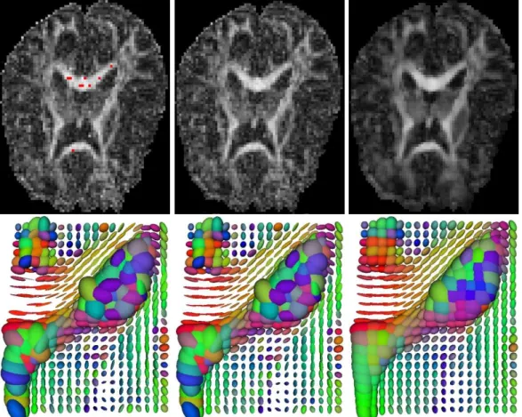 Figure 3: Estimation of brain DTI and fiber tracking. Top row (3 first images):