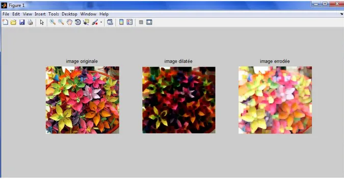 Figure IV-1 : application du filtre morphologique 