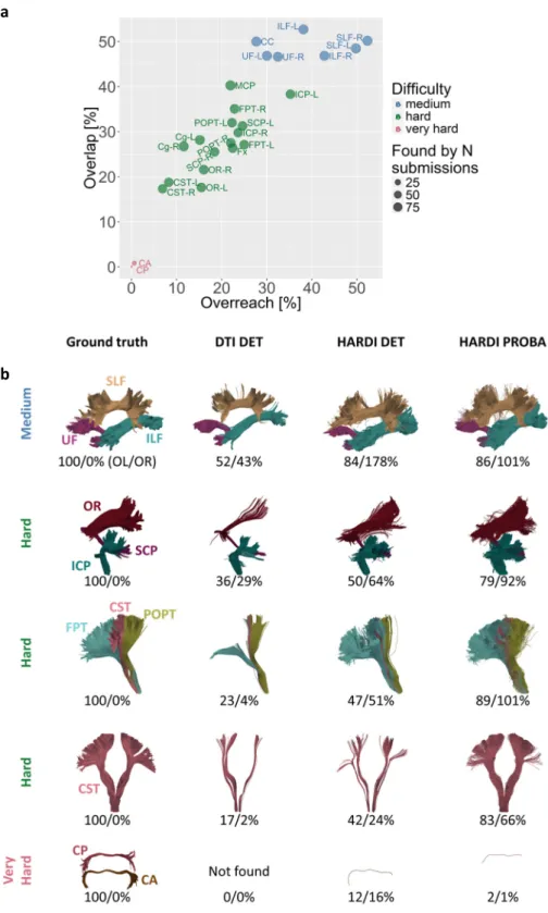 Figure  2.  Tractography  detects  major  bundles,  but  not  to  the  full  extent.  (a)  Overview  of  scores  reached for different bundles in ground truth. Average overlap  (OL) and overreach (OR) scores for  the  submissions  (red:  “very  hard”,  gre