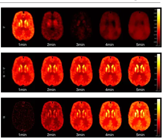 Fig. 8 Dynamic PET simulations with PE2i radiotracer: Decomposition of ICTV (0.5,0.8),0.09