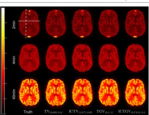Fig. 11 Dynamic PET simulations with FDG radiotracer: reconstruction methods with spa- spa-tiotemporal regularization