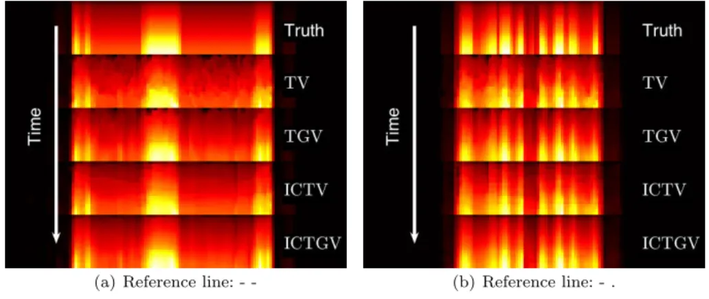 Fig. 14 FDG: Time-lines of the spatiotemporal reconstructions. The reference lines are shown in Figure 11.