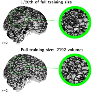 Figure A2: 1024 components trained on two different sizes of the input set of fMRI images