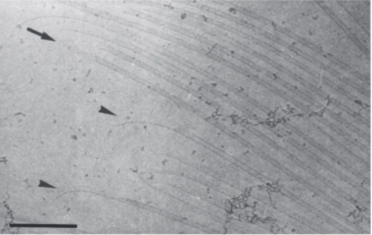 Figure 10: Protofilaments at growing microtubule ends often look slightly curved. Micro- Micro-tubules have been proposed to form sheets which later close into tubes
