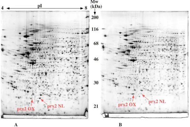 Figure 3: detection of peroxiredoxin modification 