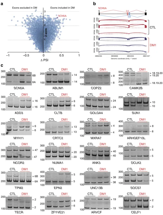 Figure 1 | Identiﬁcation of novel splicing misregulations in DM1 heart samples. (a) D-PSI versus Z-score plot of exon cassettes misregulations predicted by MISO analysis