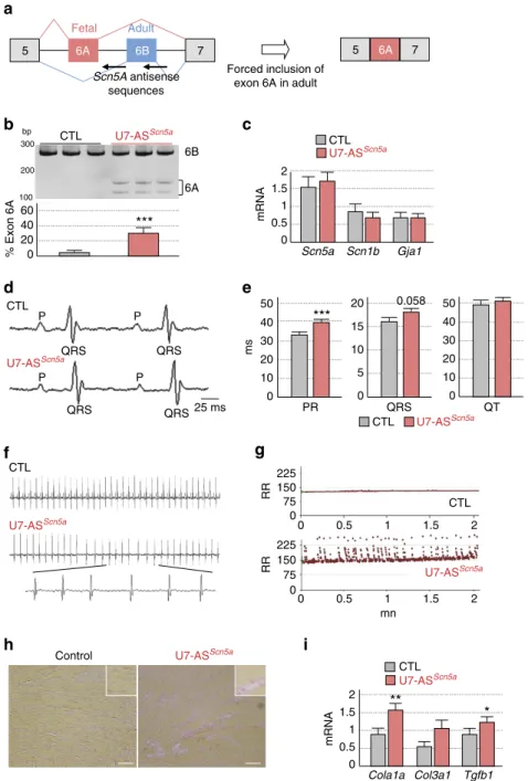 Figure 6 | Alteration of Scn5a splicing causes heart conduction defects and arrhythmias