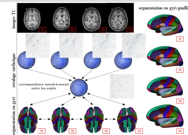 Figure 5.2 – La d´ eformation de chaque sph` ere individuelle vers un mod` ele sph´ erique et leur r´ e-