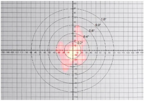 Figure 7.  Exemple de relevé d’expérience de mesure de bougé par laser [29].  Cas  pour un temps de pose de 5 secondes