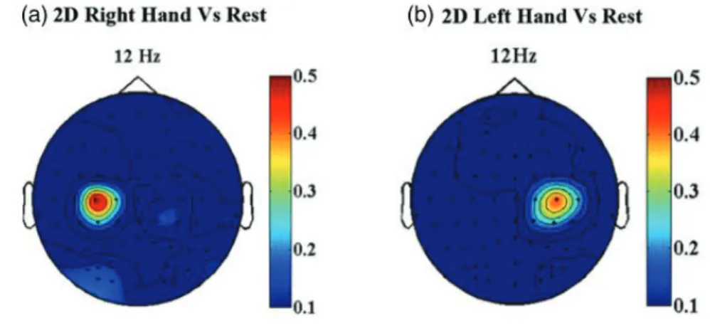 Figure 1.12: Right and left hand motor imagery (EEG) (reproduced from [LaFleur et al., 2013])