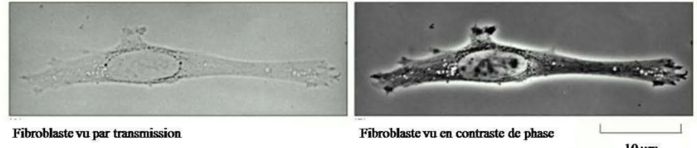 Figure 3- Images de fibroblaste en transmission et par microscopie à contraste de phase issues de [4]