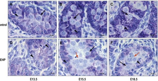 FIG. 6. AMH immunostaining in mouse testes at E13.5 (A, D), E15.5 (B, E), E18.5 (C, F) cultured for 3 days in control medium (A, B, C) or in the presence of 200lM MEHP (D, E, F)