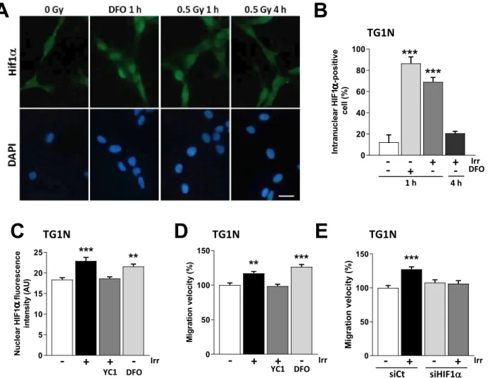 Figure 3.  A rapid and transient nuclear accumulation of HIF1α is involved in radiation-induced migration of  GSCs