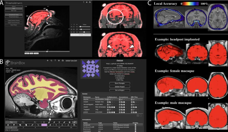 Fig. 4. Segmentation tools. A ) Thresholdmann is a brain extraction tool that creates a mask from those voxels that are brighter than a spatially varying threshold.
