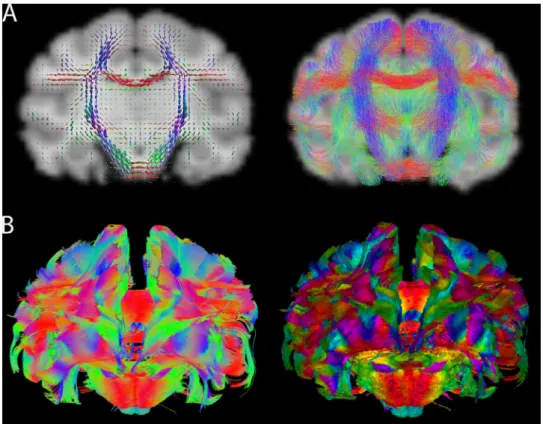 Fig. 7. Diﬀusion-weighted MRI. A ) Re- Re-sult from the Diﬀusion-MRI resource using macaque data