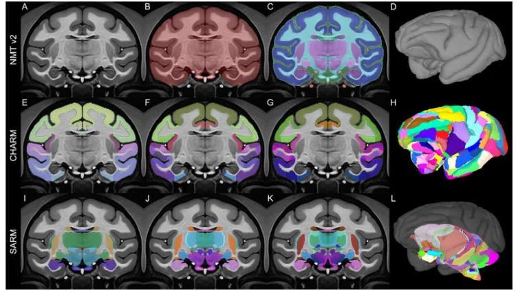 Fig. 2. Macaque Templates and Atlases. The symmetric variant of the NIMH Macaque Template v2 (NMT v2), with tissue segmentation (top row) and anatomical regions (middle and bottom rows) depicted in color on a coronal slice (11 mm anterior to ear bar zero) 