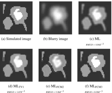 Fig. 1. Deconvolution results on a simulated blurry image us- us-ing MLEM with and without regularization approaches (TV1 and FCM)