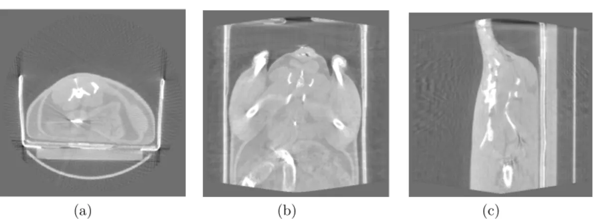 Figure 3.1.4: The first image (a) illustrates the displacement of the Barium. One can observe (in each of the views coronal (b) and saggital (c)) that the delineation of the lumen is difficult with the artifact that was created.