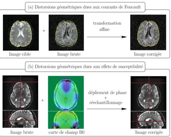 Figure adaptée de [Mangin et al., 2001] et [Poupon, 2010].