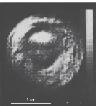 Figure 1 : Une des premières images d’un doigt obtenu par IRM (0,35T)  [3]. 