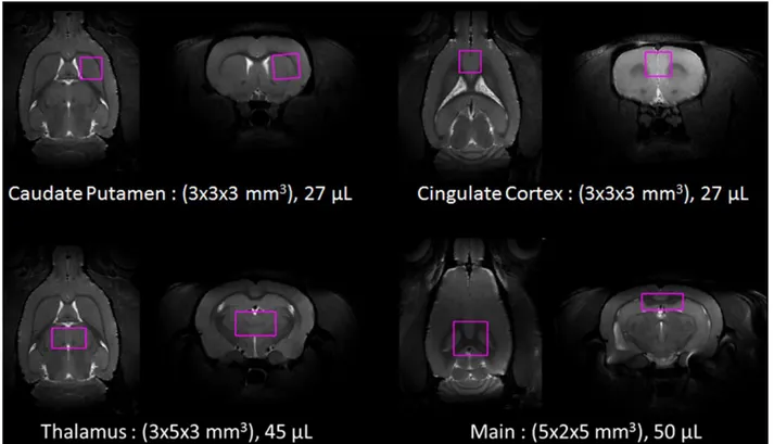 Figure 3.3. VOIs investigated during our longitudinal  1 H MRS study of normal brain aging