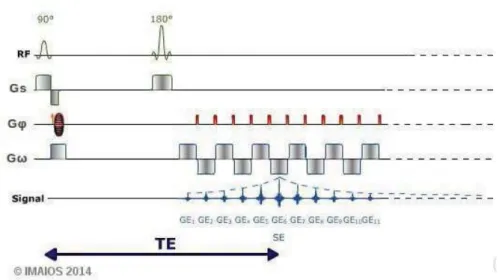 Figure 3.11: Spin Echo Echo Planar Imaging sequence from www.imaios.fr.