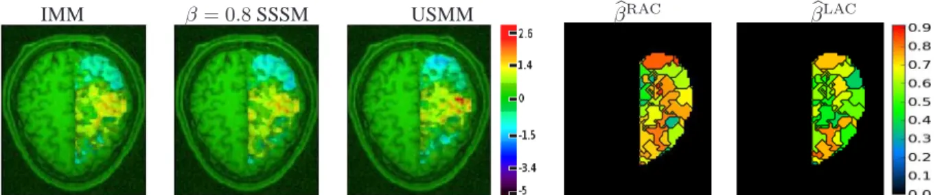 Fig. 4. Bottom: Comparison of the IMM, SSMM and USMM models wrt the estimated normalized constrat maps: left auditory clic (LAC) versus right auditory clic (RAC): a b LAC − b a RAC 