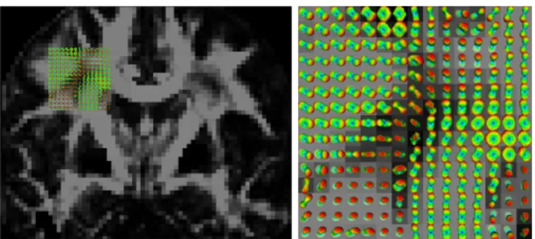 Fig. 3. We used the Riemannian method to estimate the 4th order diffusion tensors in a coronal slice, within a region of interest (ROI)