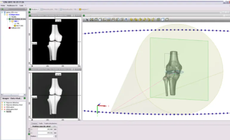 Fig. 2: Snapshot of the scene in CIVA software for the simulation of the projections of the phantom showing the 3D phantom of the knee, the detector in green and a part of the trajectory of the X-ray source.