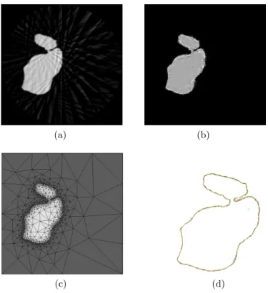 Fig. 3: Reconstructions of a 2D slice of the phantom of the knee using 36 projections with (a) the analytical FDK algorithm, (b) the ATM method - (c) the corresponding irregular mesh of the final ATM image showed in (b) and (d) Comparison of the real conto