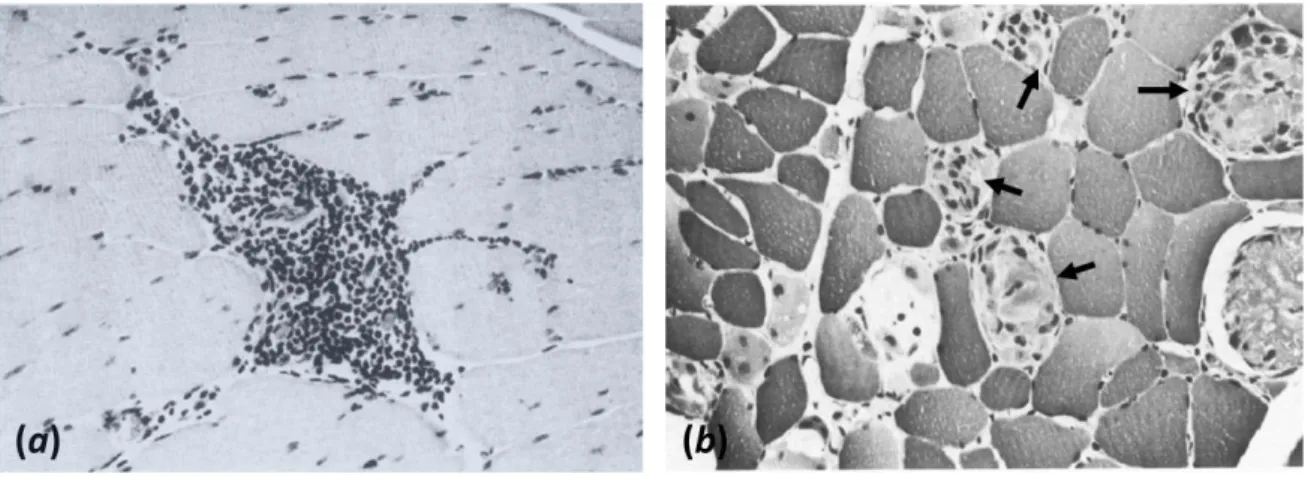 Figure 1-6 – Light microscopy image of a thin transverse section of SKM tissue revealing: 