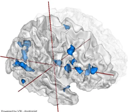 Figure 9 – Régions cérébrales impliquées dans les clusters 4D détectés