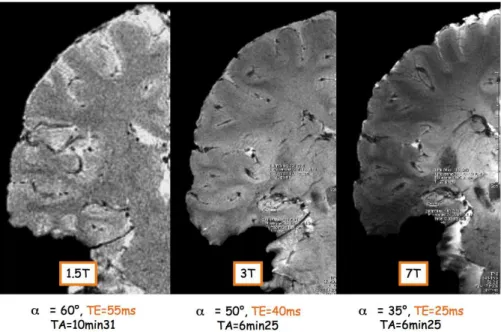 Figure 1.7: Comparison of the contrast-to-noise ratios, comparing gray matter and white matter, obtained at different field strengths on a coronal slice through the brain