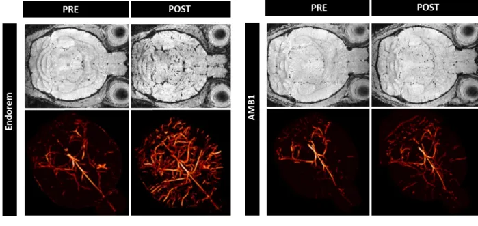 Fig. 1 – Comparaison des propri´ et´ es contrastantes in vivo de l’Endorem  R (gauche, 17 T ) et des magn´ etosomes AMB1 (droite, 11.7 T )