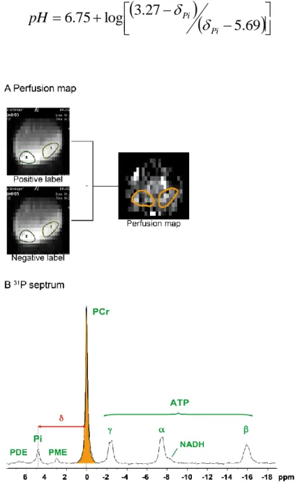 Figure S3.1. Nuclear Magnetic Resonance analysis. Multiparametric and functional  NMR  allows  measurement  of  muscle  perfusion  with  imagery  combined to  ASL and  energetic metabolism  through  31 P-spectroscopy