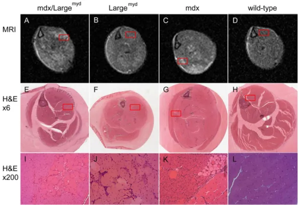 Figure 2.6: MRI versus histological analysis. MRI (A-D; TE=40 ms, TR=1500 ms)  and  histological  images  (H&amp;E,  magnification  X6:  E-H;  magnification  X200:  I-L) of  the left lower leg from mdx/Large myd  (A, E, I), Large myd  (B, F, J), mdx (C, G,