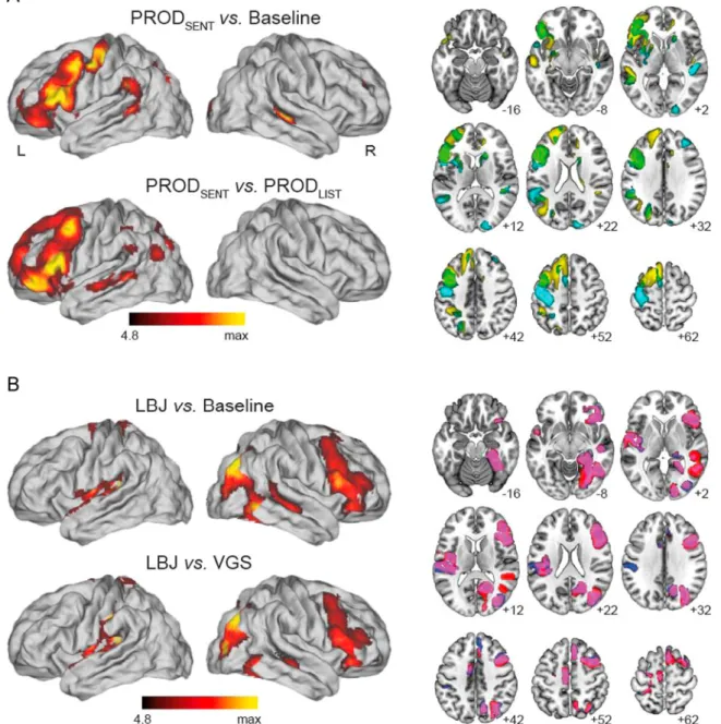 Fig. 1. Asymmetry maps for language and spatial tasks for 293 participants. Displayed results are signiﬁcant at po0.05 with family-wise error (FWE) rate correction for multiple comparisons (R: right; L: left, N¼293)