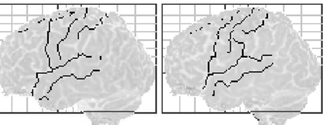 FIG. 3. The six identified sulci on the surface of the left and right hemispheres