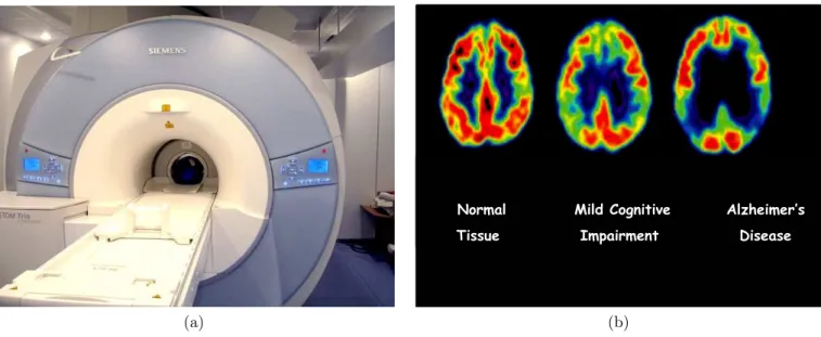 Figure 1.3: (a) The 3TMR-BrainPET MAGNETOM Tim-Trio hybrid scanner by Siemens [20] and reconstructed brain PET images (b) of normal tissue, with  cogni-tive impairment and with Alzeheimer’s disease.