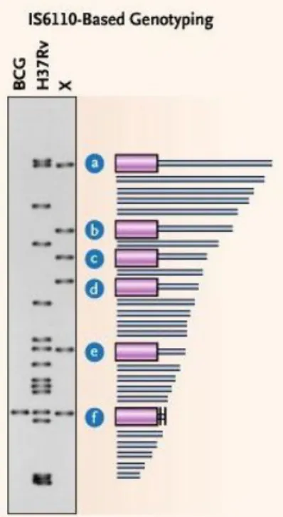 Figure 12 : Exemple de résultat de IS6110-RFLP. a, b, c, d, e, f indiquent les fragments de la  souche H37Rv porteurs de IS6110 révélés par Southern (Barnes and Cave 2003)