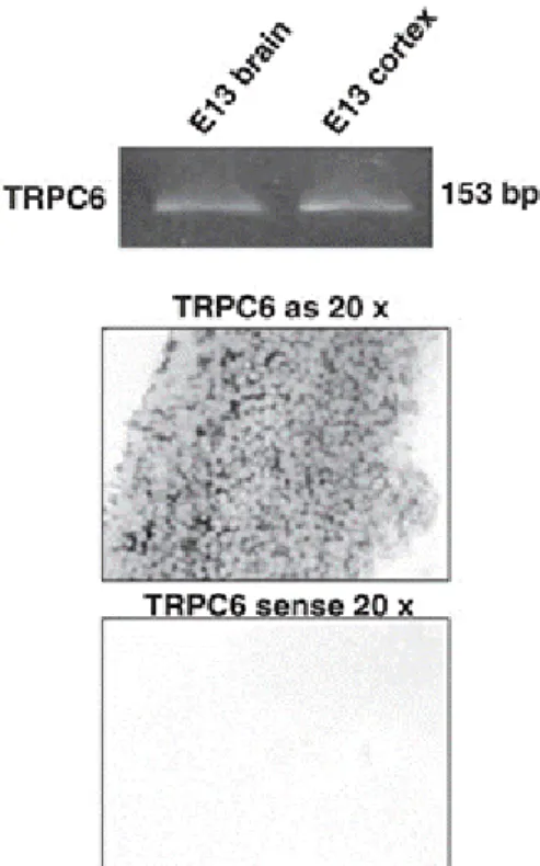 Figure 21 Les canaux TRPC6 sont présents dans le cerveau des embryons murins à E13 