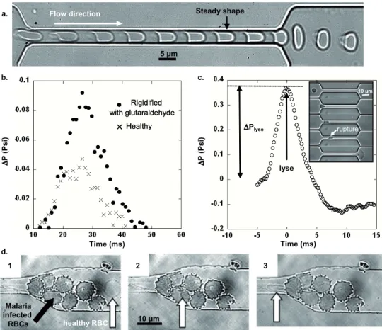 Figure 5.13: Time-lapse sequence of deformation of a healthy RBC flowing in a close-fitting 100 µm long channel (time lapse of 10 ms)