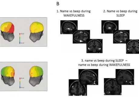 Figure 17. Reaction to subject’s own name 